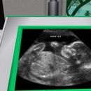 Thumb 53d9813ff8a1ec5a32000001