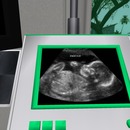 Thumb 53d983f8a73e21030b000001