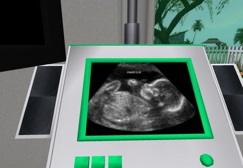 Web 53d983f8a73e21030b000001