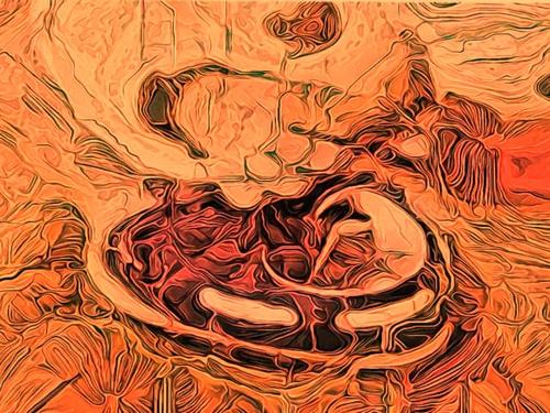 Web 5a8d5935d774f82a04000001