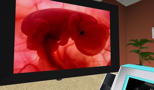 Web 543ebd008da5724fa3000001