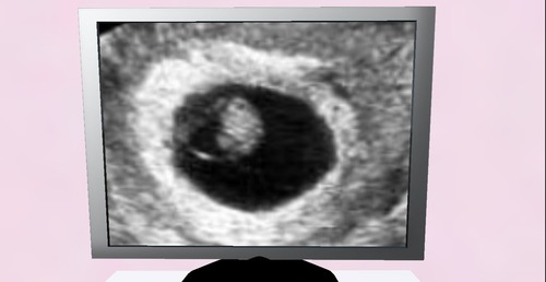 Web 5307a5498da57230a3000001