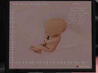 Small 61c100f0dcfb6105a5faf784